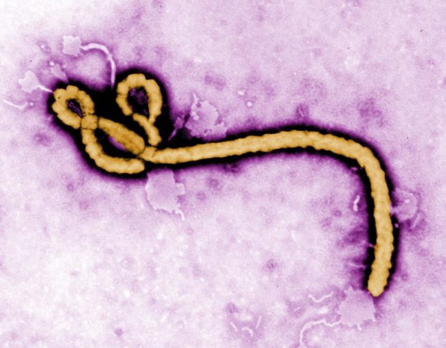 Ebola Hemorrhagic Fever (Category A) Source CDC Frederick Murphy